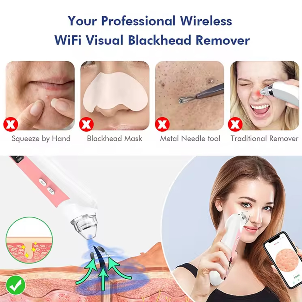 Limpiador de poros de 6 cabeza - Nasal Aspirator reseña y precio