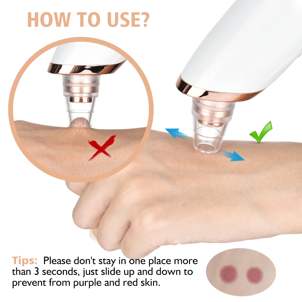 Removedor de espinillas, limpi - Nasal Aspirator reseña y precio
