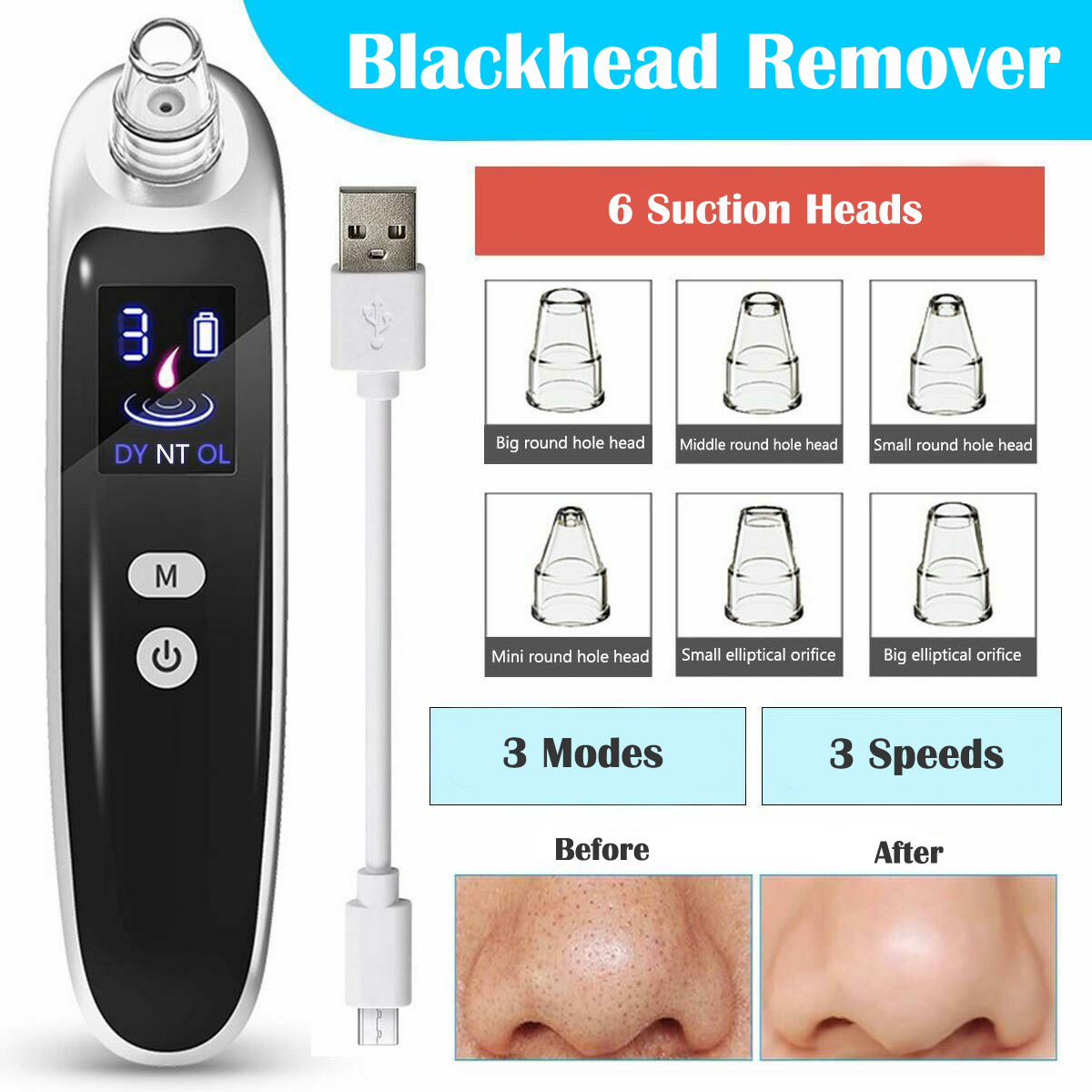 Removedor Eléctrico de Puntos  - Nasal Aspirator reseña y precio